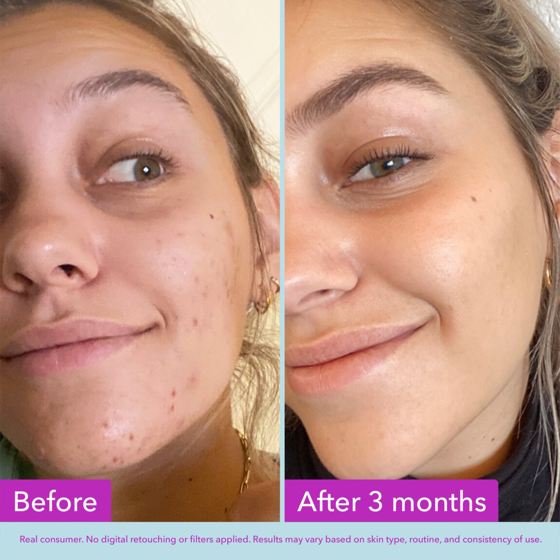 niacinamide-brightening-toner-l1 zb_p.jpg