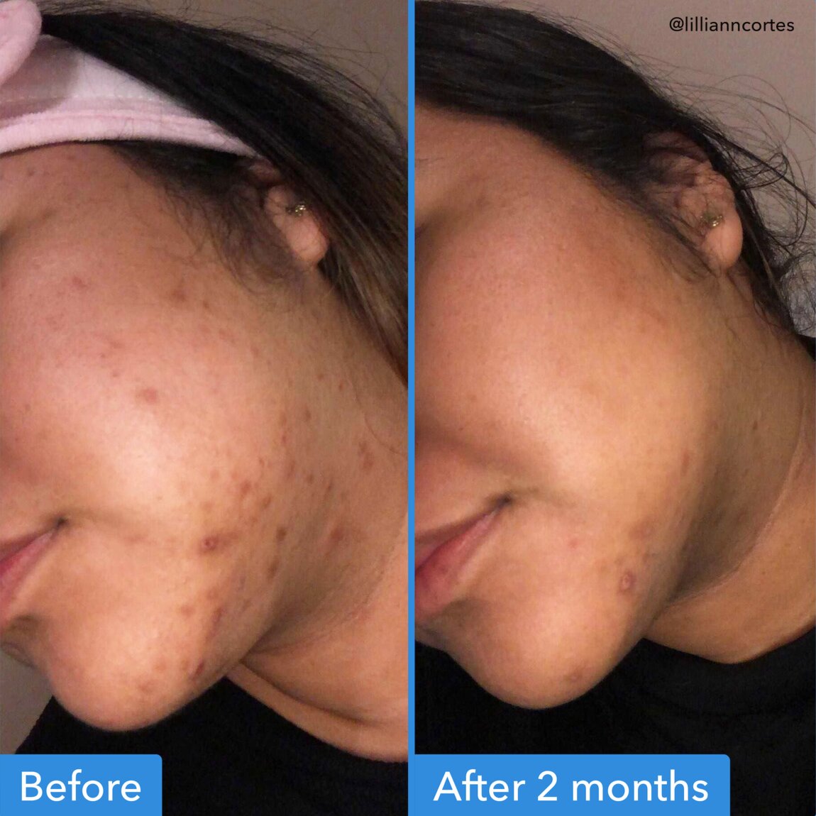 discoloration-correcting-serum-z8 zb_p.jpg