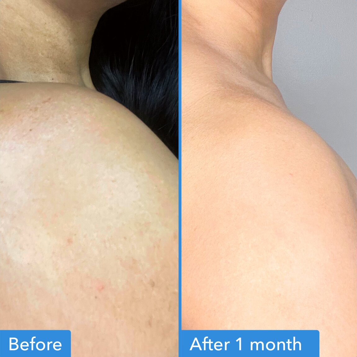 discoloration-correcting-body-treatment-c1 zb_p.jpg